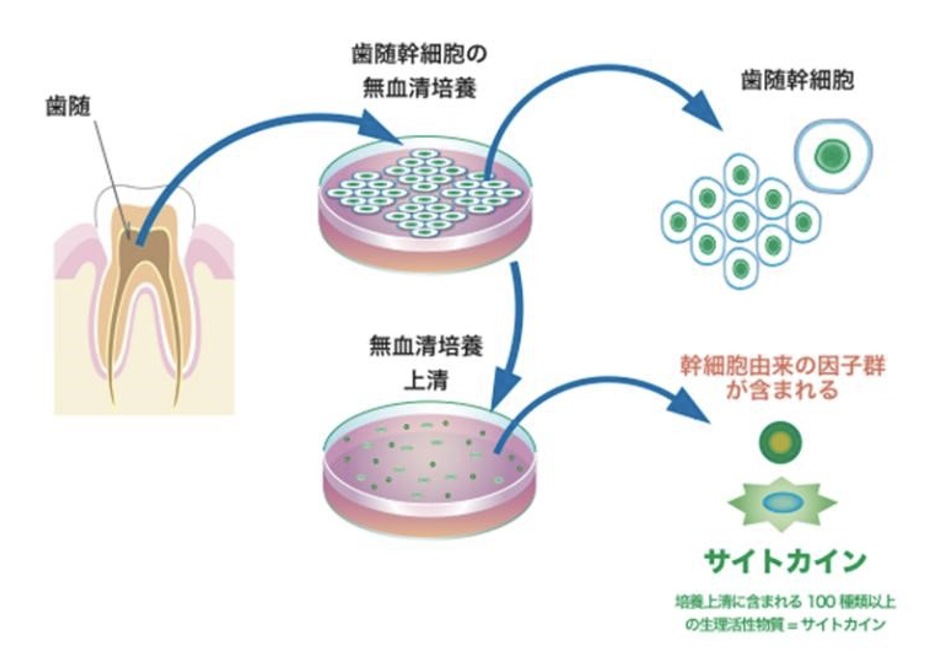 プラセンタ注射・点滴